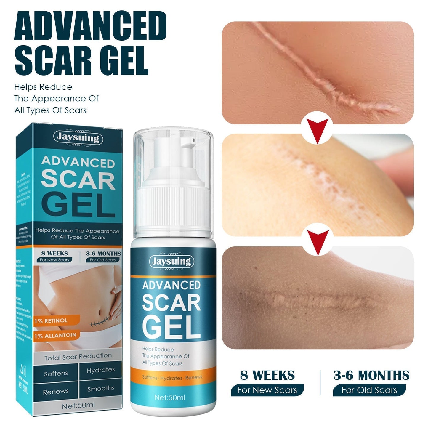 Jaysuing™ Fade Scar Cream Scar Repair Cream For All Scars(50 ml,1.7 oz)